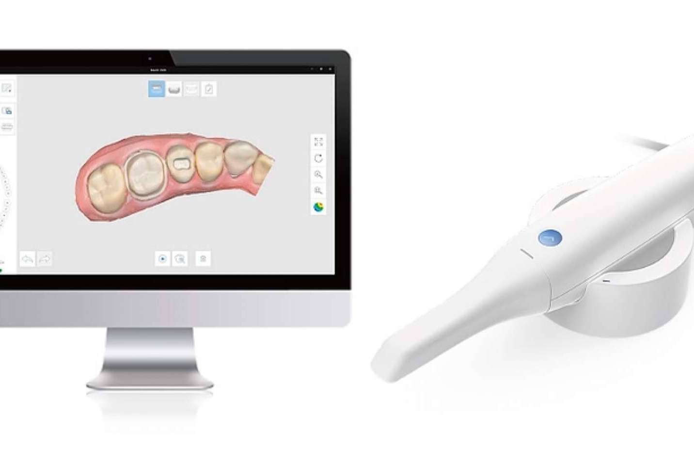 Tecnología 3D con escáner oral para no más pastas en boca